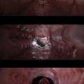 Anaconda (1997) – camera inside the titular snake as it snacks on Jon&nbsp;Voight