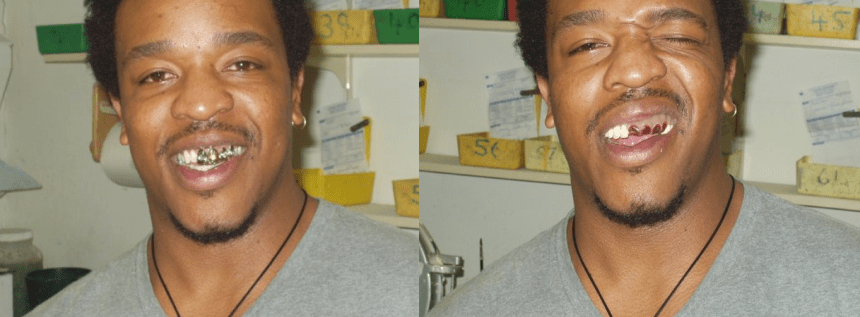 Archer Teeth Get Rich